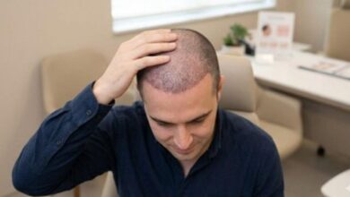 Hair Transplant