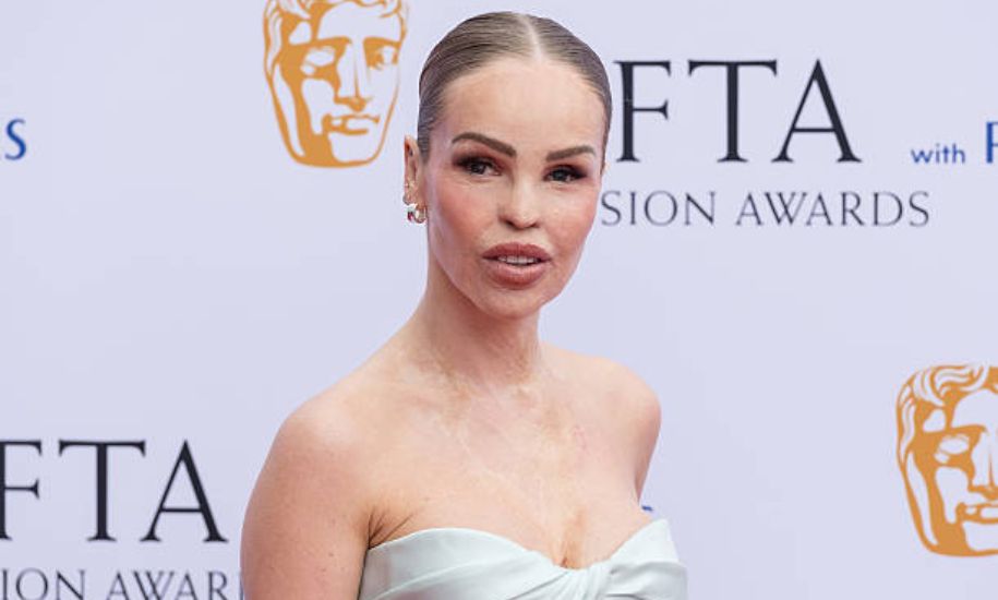 Katie Piper