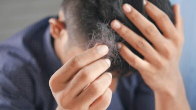 Hair Loss Solution