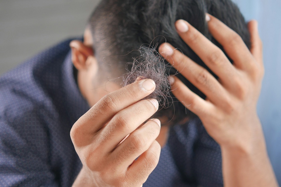 Hair Loss Solution